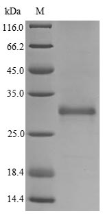 VWC2L Protein - (Tris-Glycine gel) Discontinuous SDS-PAGE (reduced) with 5% enrichment gel and 15% separation gel.