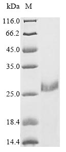 VWC2L Protein - (Tris-Glycine gel) Discontinuous SDS-PAGE (reduced) with 5% enrichment gel and 15% separation gel.