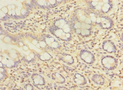 ZFAND2A Antibody - Immunohistochemistry of paraffin-embedded human small intestine tissue using antibody at dilution of 1:100.