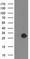 ZFAND2B Antibody - HEK293T cells were transfected with the pCMV6-ENTRY control (Left lane) or pCMV6-ENTRY ZFAND2B (Right lane) cDNA for 48 hrs and lysed. Equivalent amounts of cell lysates (5 ug per lane) were separated by SDS-PAGE and immunoblotted with anti-ZFAND2B.
