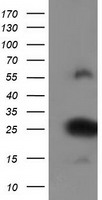 ZFAND2B Antibody - HEK293T cells were transfected with the pCMV6-ENTRY control (Left lane) or pCMV6-ENTRY ZFAND2B (Right lane) cDNA for 48 hrs and lysed. Equivalent amounts of cell lysates (5 ug per lane) were separated by SDS-PAGE and immunoblotted with anti-ZFAND2B.