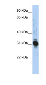 ZFAND3 / TEX27 Antibody - ZFAND3 antibody Western blot of Transfected 293T cell lysate. This image was taken for the unconjugated form of this product. Other forms have not been tested.