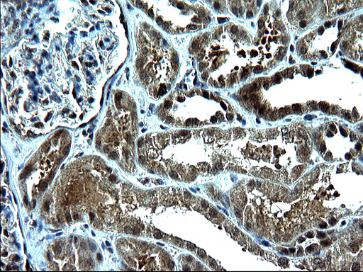 ZFAND3 / TEX27 Antibody - IHC of paraffin-embedded Human Kidney tissue using anti-ZFAND3 mouse monoclonal antibody. (Heat-induced epitope retrieval by 1 mM EDTA in 10mM Tris, pH8.5, 120°C for 3min).