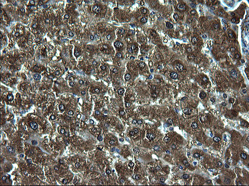 ZFAND3 / TEX27 Antibody - IHC of paraffin-embedded Human liver tissue using anti-ZFAND3 mouse monoclonal antibody. (Heat-induced epitope retrieval by 1 mM EDTA in 10mM Tris, pH8.5, 120°C for 3min).