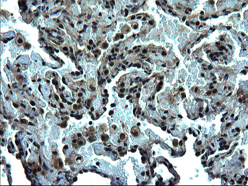 ZFAND3 / TEX27 Antibody - IHC of paraffin-embedded Human lung tissue using anti-ZFAND3 mouse monoclonal antibody. (Heat-induced epitope retrieval by 1 mM EDTA in 10mM Tris, pH8.5, 120°C for 3min).