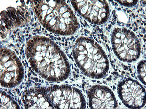 ZFAND3 / TEX27 Antibody - IHC of paraffin-embedded Human colon tissue using anti-ZFAND3 mouse monoclonal antibody. (Heat-induced epitope retrieval by 1 mM EDTA in 10mM Tris, pH8.5, 120°C for 3min).