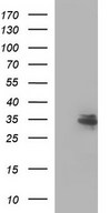 ZFAND3 / TEX27 Antibody - HEK293T cells were transfected with the pCMV6-ENTRY control (Left lane) or pCMV6-ENTRY ZFAND3 (Right lane) cDNA for 48 hrs and lysed. Equivalent amounts of cell lysates (5 ug per lane) were separated by SDS-PAGE and immunoblotted with anti-ZFAND3.