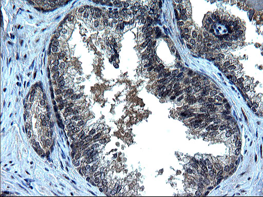 ZFAND3 / TEX27 Antibody - IHC of paraffin-embedded Human prostate tissue using anti-ZFAND3 mouse monoclonal antibody. (Heat-induced epitope retrieval by 1 mM EDTA in 10mM Tris, pH8.5, 120°C for 3min).