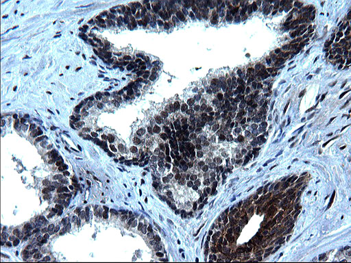 ZFAND3 / TEX27 Antibody - IHC of paraffin-embedded Human prostate tissue using anti-ZFAND3 mouse monoclonal antibody. (Heat-induced epitope retrieval by 1 mM EDTA in 10mM Tris, pH8.5, 120°C for 3min).
