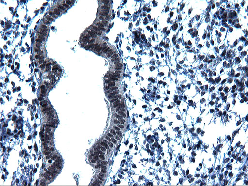 ZFAND3 / TEX27 Antibody - IHC of paraffin-embedded Human endometrium tissue using anti-ZFAND3 mouse monoclonal antibody. (Heat-induced epitope retrieval by 1 mM EDTA in 10mM Tris, pH8.5, 120°C for 3min).