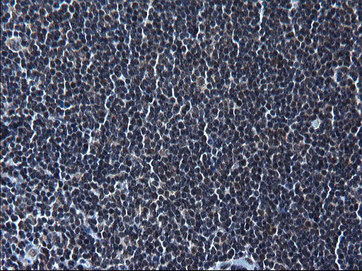 ZFAND3 / TEX27 Antibody - IHC of paraffin-embedded Human lymph node tissue using anti-ZFAND3 mouse monoclonal antibody. (Heat-induced epitope retrieval by 1 mM EDTA in 10mM Tris, pH8.5, 120°C for 3min).