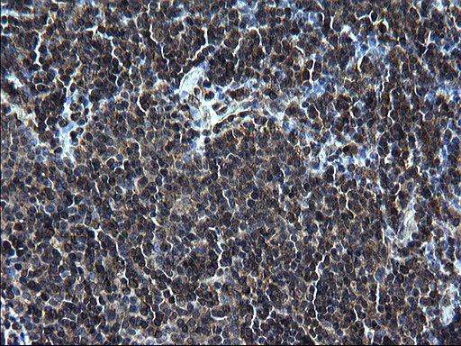 ZFAND3 / TEX27 Antibody - IHC of paraffin-embedded Human lymph node tissue using anti-ZFAND3 mouse monoclonal antibody. (Heat-induced epitope retrieval by 1 mM EDTA in 10mM Tris, pH8.5, 120°C for 3min).