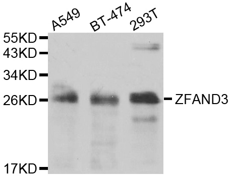ZFAND3 / TEX27 Antibody - Western blot analysis of extracts of various cell lines.