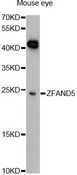 ZFAND5 Antibody - Western blot analysis of extracts of mouse eye, using ZFAND5 Antibody at 1:1000 dilution. The secondary antibody used was an HRP Goat Anti-Rabbit IgG (H+L) at 1:10000 dilution. Lysates were loaded 25ug per lane and 3% nonfat dry milk in TBST was used for blocking. An ECL Kit was used for detection and the exposure time was 90s.