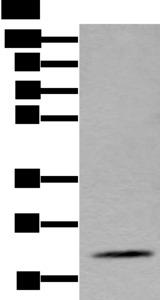 ZFAND5 Antibody - Western blot analysis of Mouse fat tissue lysate  using ZFAND5 Polyclonal Antibody at dilution of 1:500