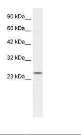 ZFAND6 Antibody - Jurkat Cell Lysate.  This image was taken for the unconjugated form of this product. Other forms have not been tested.