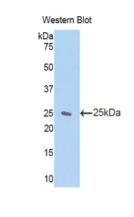 ZFAND6 Antibody - Western blot of recombinant ZFAND6.  This image was taken for the unconjugated form of this product. Other forms have not been tested.