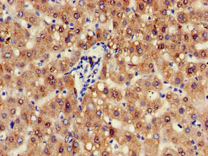 ZFAND6 Antibody - Immunohistochemistry of paraffin-embedded human liver tissue at dilution of 1:100