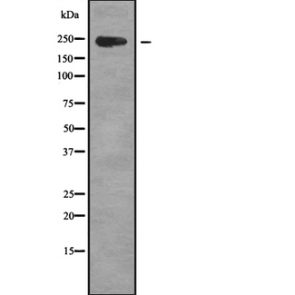 ZFC3H1 Antibody - Western blot analysis of CCDC131 using Jurkat whole cells lysates