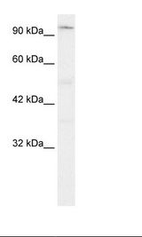 ZFHX2 / ZNF409 Antibody - Jurkat Cell Lysate.  This image was taken for the unconjugated form of this product. Other forms have not been tested.
