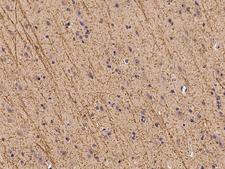 ZFHX2 / ZNF409 Antibody - Immunochemical staining of human ZNF409 in human brain with rabbit polyclonal antibody at 1:100 dilution, formalin-fixed paraffin embedded sections.
