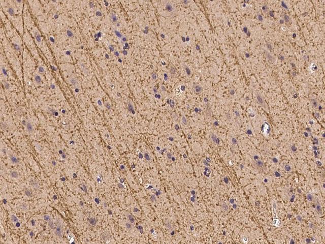 ZFHX2 / ZNF409 Antibody - Immunochemical staining of human ZNF409 in human brain with rabbit polyclonal antibody at 1:100 dilution, formalin-fixed paraffin embedded sections.
