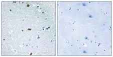 ZFHX3 / ATBF1 Antibody - Immunohistochemistry analysis of paraffin-embedded human brain tissue, using ZFHX3 Antibody. The picture on the right is blocked with the synthesized peptide.
