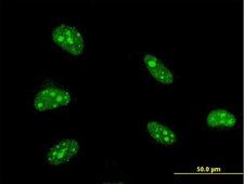 ZFHX3 / ATBF1 Antibody - Immunofluorescence of monoclonal antibody to ZFHX3 on HeLa cell . [antibody concentration 10 ug/ml]