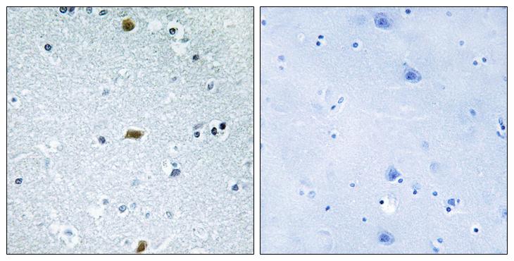 ZFHX3 / ATBF1 Antibody - Peptide - + Immunohistochemistry analysis of paraffin-embedded human brain tissue, using ZFHX3 antibody.