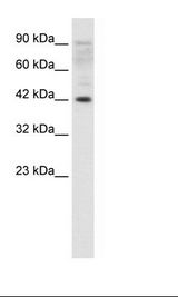 ZFP1 Antibody - Jurkat Cell Lysate.  This image was taken for the unconjugated form of this product. Other forms have not been tested.