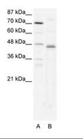 ZFP1 Antibody - A: Marker, B: HepG2 Cell Lysate.  This image was taken for the unconjugated form of this product. Other forms have not been tested.