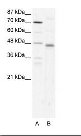 ZFP1 Antibody - A: Marker, B: HepG2 Cell Lysate.  This image was taken for the unconjugated form of this product. Other forms have not been tested.