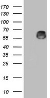 Zfp105 / ZNF35 Antibody - HEK293T cells were transfected with the pCMV6-ENTRY control. (Left lane) or pCMV6-ENTRY ZNF35. (Right lane) cDNA for 48 hrs and lysed. Equivalent amounts of cell lysates. (5 ug per lane) were separated by SDS-PAGE and immunoblotted with anti-ZNF35. (1:2000)
