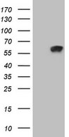 Zfp105 / ZNF35 Antibody - HEK293T cells were transfected with the pCMV6-ENTRY control (Left lane) or pCMV6-ENTRY ZNF35 (Right lane) cDNA for 48 hrs and lysed. Equivalent amounts of cell lysates (5 ug per lane) were separated by SDS-PAGE and immunoblotted with anti-ZNF35 (1:2000).