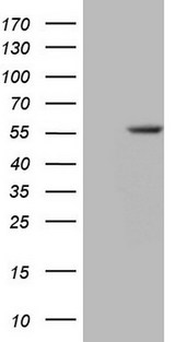 Zfp105 / ZNF35 Antibody - HEK293T cells were transfected with the pCMV6-ENTRY control. (Left lane) or pCMV6-ENTRY ZNF35. (Right lane) cDNA for 48 hrs and lysed. Equivalent amounts of cell lysates. (5 ug per lane) were separated by SDS-PAGE and immunoblotted with anti-ZNF35.