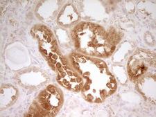 Zfp105 / ZNF35 Antibody - Immunohistochemical staining of paraffin-embedded Human Kidney tissue within the normal limits using anti-ZNF35 mouse monoclonal antibody. (Heat-induced epitope retrieval by 1 mM EDTA in 10mM Tris, pH8.5, 120C for 3min,