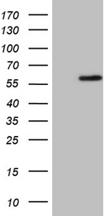 Zfp105 / ZNF35 Antibody - HEK293T cells were transfected with the pCMV6-ENTRY control. (Left lane) or pCMV6-ENTRY ZNF35. (Right lane) cDNA for 48 hrs and lysed