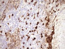 Zfp105 / ZNF35 Antibody - Immunohistochemical staining of paraffin-embedded Human lymph node tissue within the normal limits using anti-ZNF35 mouse monoclonal antibody. (Heat-induced epitope retrieval by 1mM EDTA in 10mM Tris buffer. (pH8.5) at 120°C for 3 min. (1:150)