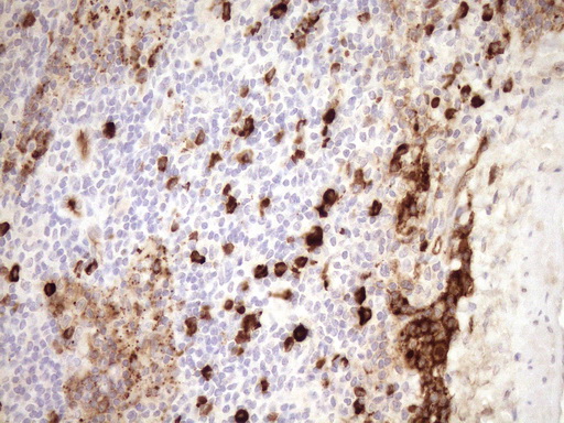 Zfp105 / ZNF35 Antibody - Immunohistochemical staining of paraffin-embedded Human lymph node tissue within the normal limits using anti-ZNF35 mouse monoclonal antibody. (Heat-induced epitope retrieval by 1mM EDTA in 10mM Tris buffer. (pH8.5) at 120°C for 3 min. (1:150)