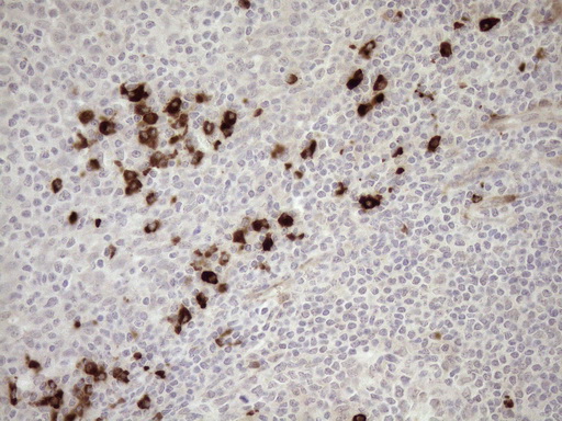 Zfp105 / ZNF35 Antibody - Immunohistochemical staining of paraffin-embedded Human tonsil within the normal limits using anti-ZNF35 mouse monoclonal antibody. (Heat-induced epitope retrieval by 1mM EDTA in 10mM Tris buffer. (pH8.5) at 120°C for 3 min. (1:150)