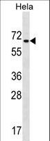 Zfp105 / ZNF35 Antibody - ZNF35 Antibody western blot of HeLa cell line lysates (35 ug/lane). The ZNF35 antibody detected the ZNF35 protein (arrow).