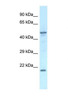 Zfp113 Antibody - Zfp113 antibody Western blot of Mouse Kidney lysate. Antibody concentration 1 ug/ml.  This image was taken for the unconjugated form of this product. Other forms have not been tested.
