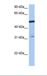 ZFP14 Antibody - Jurkat cell lysate. Antibody concentration: 1.0 ug/ml. Gel concentration: 12%.  This image was taken for the unconjugated form of this product. Other forms have not been tested.