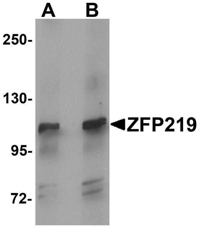 ZFP219 / ZNF219 Antibody - Western blot analysis of ZFP219 in mouse brain tissue lysate with ZFP219 antibody at (A) 1 and (B) 2 ug/ml.