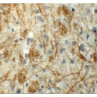 ZFP219 / ZNF219 Antibody - Immunohistochemistry of ZFP219 in mouse brain tissue with ZFP219 antibody at 5 µg/mL.
