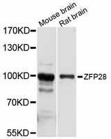 ZFP28 Antibody - Western blot analysis of extracts of various cell lines, using ZFP28 antibody at 1:1000 dilution. The secondary antibody used was an HRP Goat Anti-Rabbit IgG (H+L) at 1:10000 dilution. Lysates were loaded 25ug per lane and 3% nonfat dry milk in TBST was used for blocking. An ECL Kit was used for detection and the exposure time was 10s.