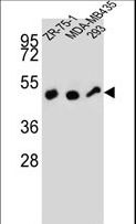 ZFP30 Antibody - ZFP30 Antibody western blot of ZR-75-1,MDA-MB435,293 cell line lysates (35 ug/lane). The ZFP30 antibody detected the ZFP30 protein (arrow).