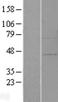 ZFP30 Protein - Western validation with an anti-DDK antibody * L: Control HEK293 lysate R: Over-expression lysate