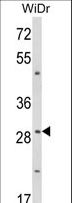 ZFP36 / Tristetraprolin Antibody - Western blot of ZFP36 Antibody in WiDr cell line lysates (35 ug/lane). ZFP36 (arrow) was detected using the purified antibody.