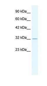 ZFP36 / Tristetraprolin Antibody - ZFP36 antibody Western blot of HepG2 cell lysate. This image was taken for the unconjugated form of this product. Other forms have not been tested.